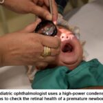 Screening gaps raise blindness risk for premature babies.