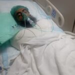 PESCO Lineman Seriously Injured in Electrocution Incident, Union Demands Inquiry